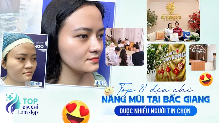 Top 8 Địa Chỉ Nâng Mũi Tại Bắc Giang Được Nhiều Người Tin Chọn