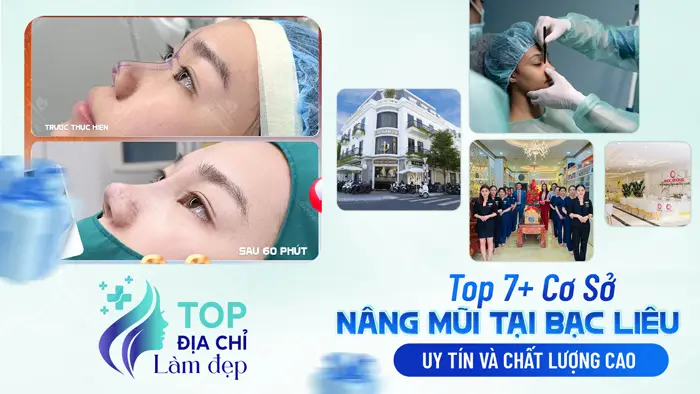 Top 7+ Cơ Sở Nâng Mũi Tại Bạc Liêu Uy Tín Và Chất Lượng Cao