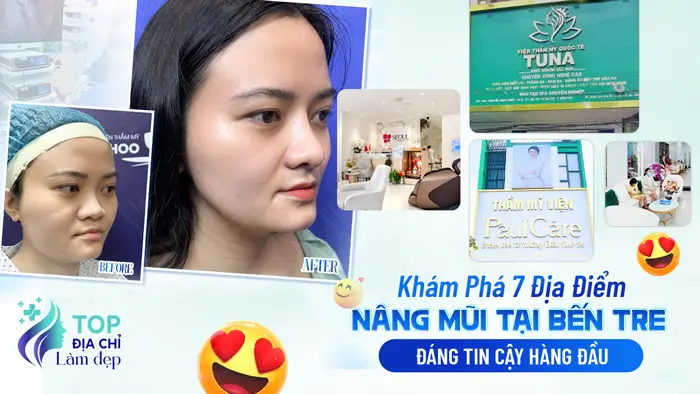 Khám Phá 7 Địa Điểm Nâng Mũi Tại Bến Tre Đáng Tin Cậy Hàng Đầu