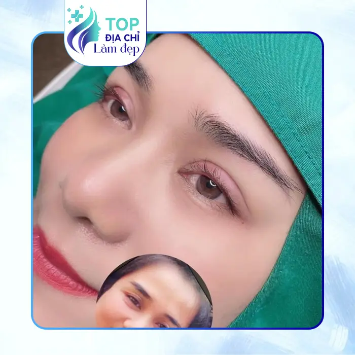 Khám Phá 7 Địa Điểm Nâng Mũi Tại Cao Bằng An Toàn – Chất Lượng