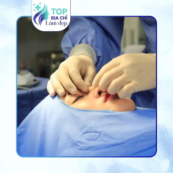 Khám Phá 7 Cơ Sở Nâng Mũi Tại Hà Nam Đáng Tin Cậy Không Nên Bỏ Qua