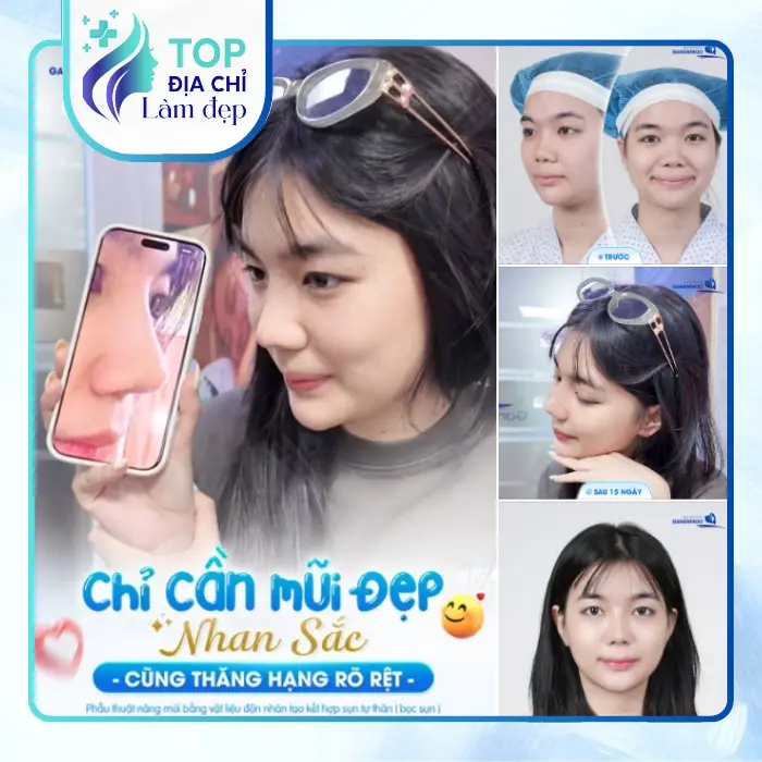 7 Cơ Sở Nâng Mũi Tại Hà Tĩnh Đi Đầu Về Chất Lượng & Dịch Vụ