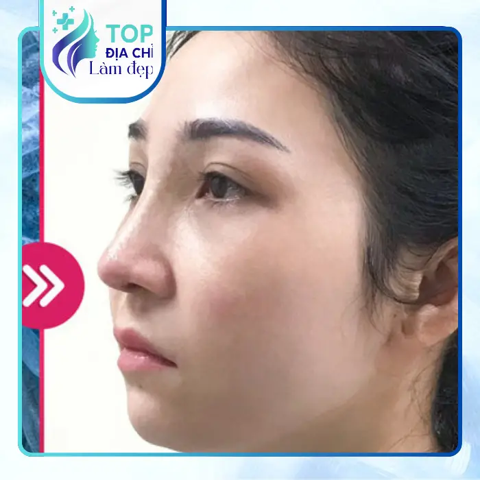 Review Những Cơ Sở Nâng Mũi Uy Tín Được Khách Hàng Đánh Giá Cao Ở Quảng Trị