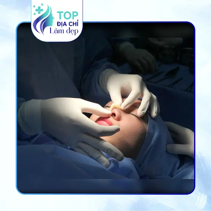 7 Nơi Nâng Mũi Tại Hậu Giang An Toàn, Chất Lượng và Uy Tín