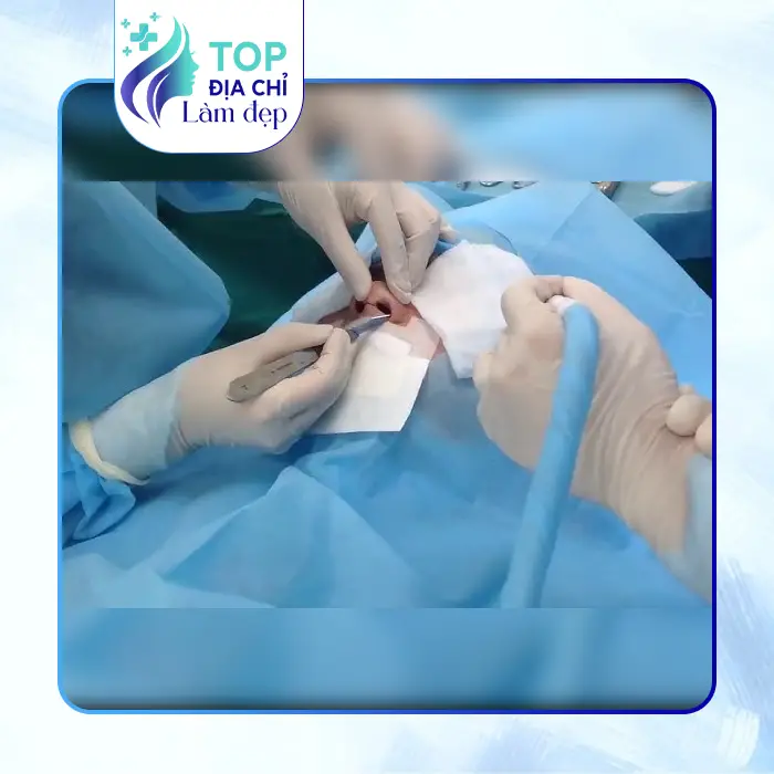 7 Nơi Nâng Mũi Tại Hậu Giang An Toàn, Chất Lượng và Uy Tín