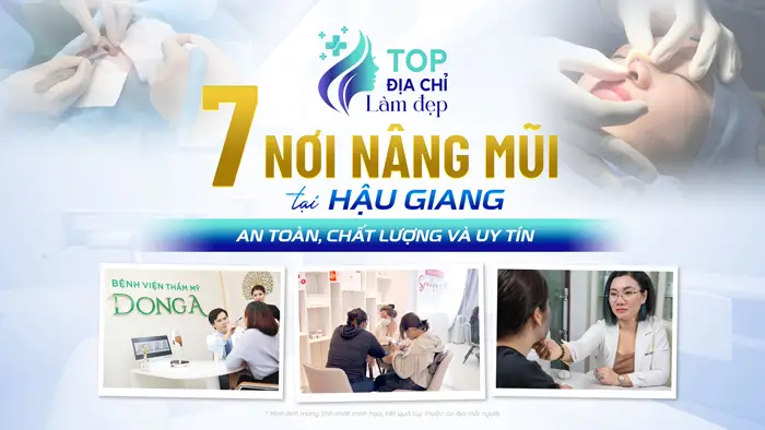 7 Nơi Nâng Mũi Tại Hậu Giang An Toàn, Chất Lượng và Uy Tín