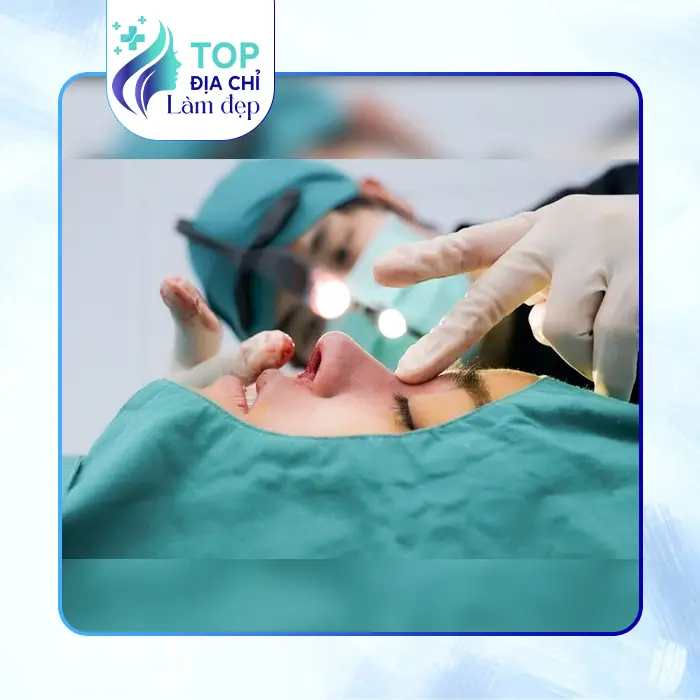 7 Cơ Sở Nâng Mũi Tại Hòa Bình Top Đầu Chất Lượng Nên Làm Sớm