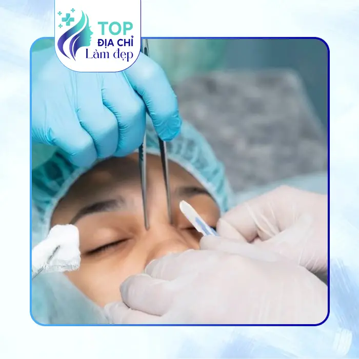 7 Cơ Sở Nâng Mũi Tại Hòa Bình Top Đầu Chất Lượng Nên Làm Sớm