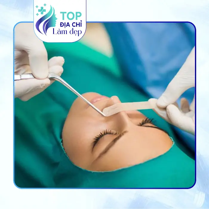 Các Cơ Sở Nâng Mũi Uy Tín, An Toàn Hàng Đầu Ở Kon Tum Hiện Nay