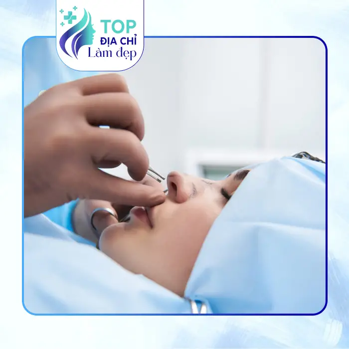 Các Cơ Sở Nâng Mũi Uy Tín, An Toàn Hàng Đầu Ở Kon Tum Hiện Nay