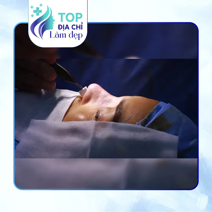 Khám Phá Top 7 Địa Điểm Nâng Mũi Tại Lai Châu Chất Lượng Cao