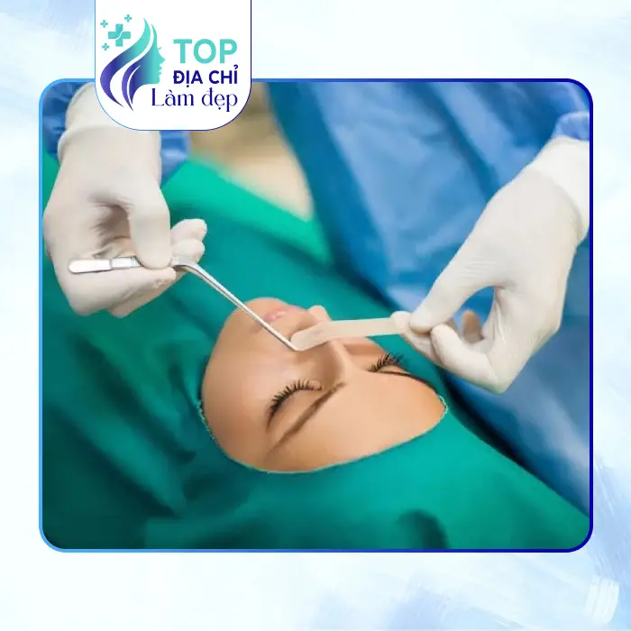 Khám Phá 7 Cơ Sở Nâng Mũi Tại Ninh Bình: Uy Tín & An Toàn