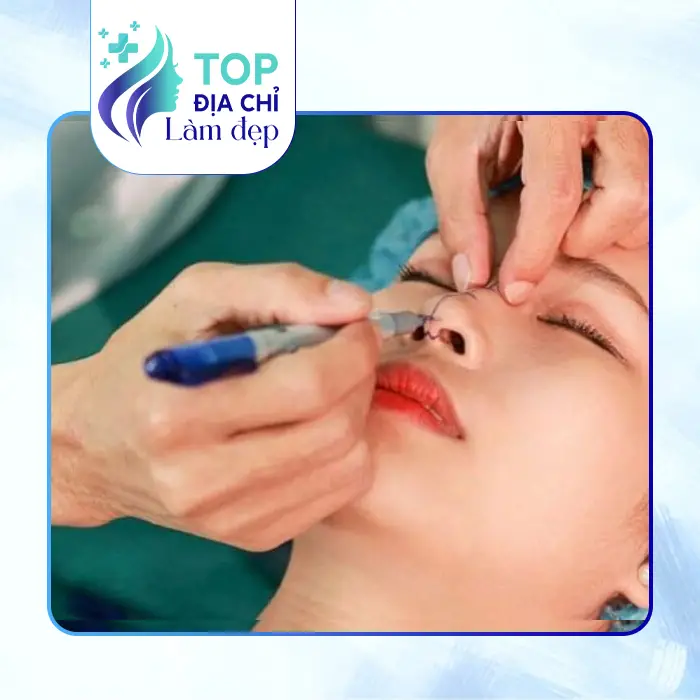 Khám Phá Top 7+ Địa Điểm Nâng Mũi Tại Quận 4 TP.HCM Được Review Tốt