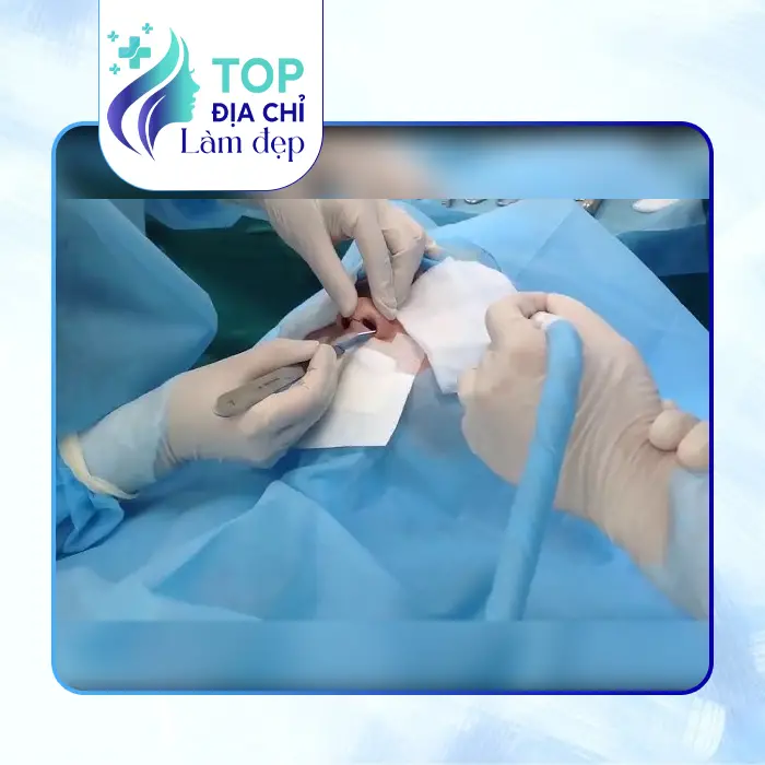 Khám Phá Top 7 Nơi Nâng Mũi Tại Quận 5 TP.HCM Được Nhiều Người Lựa Chọn