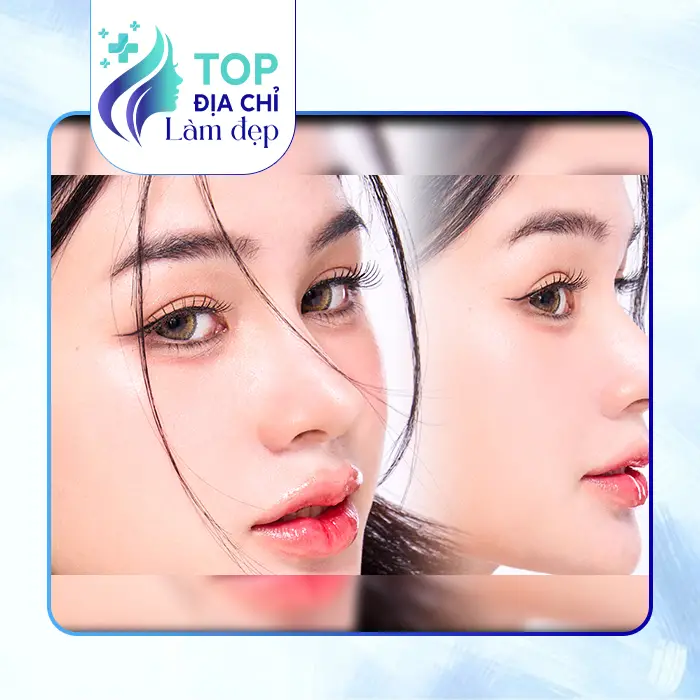 Khám Phá 8 Nơi Nâng Mũi Tại Quận 8 TP.HCM Được Tin Tưởng Nhất Hiện Nay