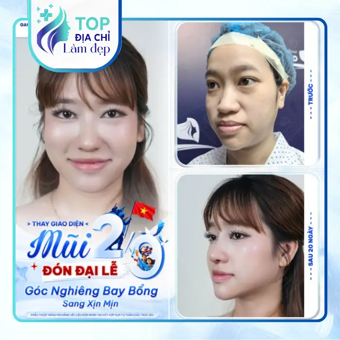 Khám Phá 8 Nơi Nâng Mũi Tại Quận 8 TP.HCM Được Tin Tưởng Nhất Hiện Nay