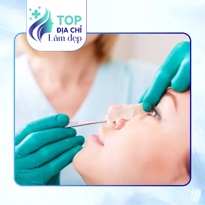 Khám Phá 7 Cơ Sở Nâng Mũi Tại Gò Vấp TP.HCM Chất Lượng Hàng Đầu