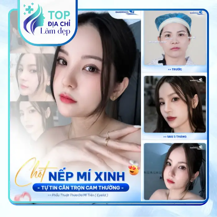 Top 7 Địa chỉ cắt mí mắt tại Hà Nam an toàn và uy tín