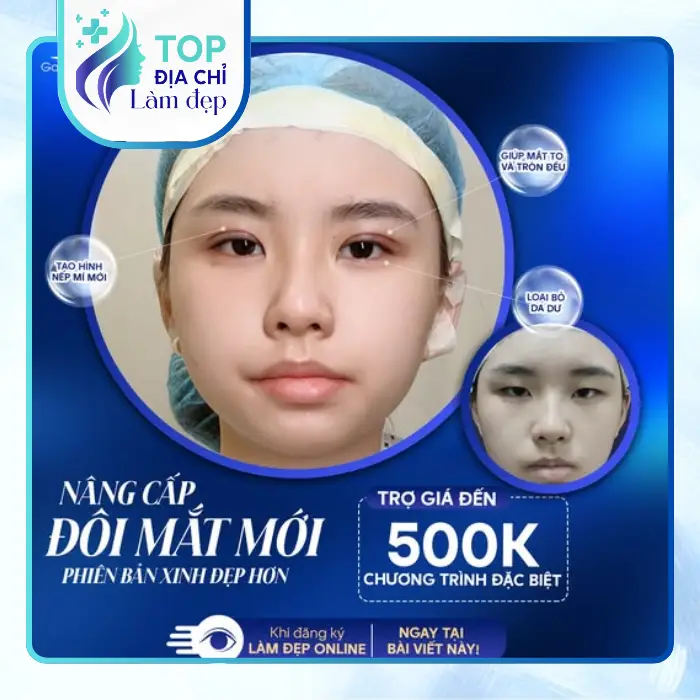 Danh Sách 3 Địa Chỉ Cắt Mí Mắt Uy Tín Tại Hưng Yên Và Tiêu Chí Chọn Cơ Sở An Toàn