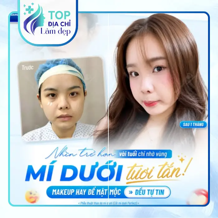 Top 5 địa chỉ nhấn mí, cắt mí được nhiều khách hàng tin chọn tại Lai Châu