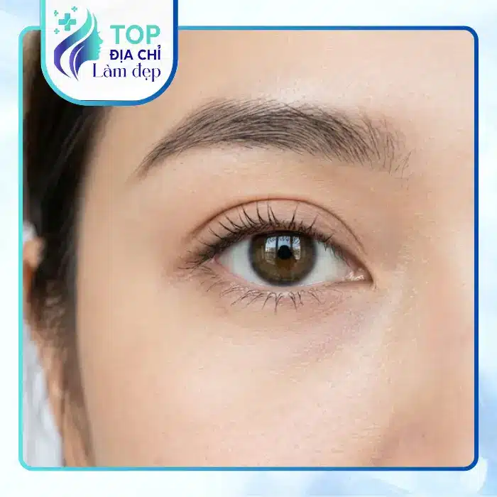 Địa chỉ top 5 cắt mí mắt tốt nhất tại Phú Thọ bạn nên biết
