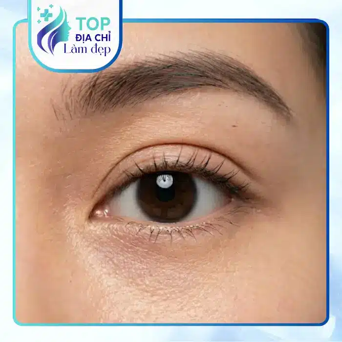 Top 5 cơ sở cắt mí mắt tại Quảng Bình chất lượng cao