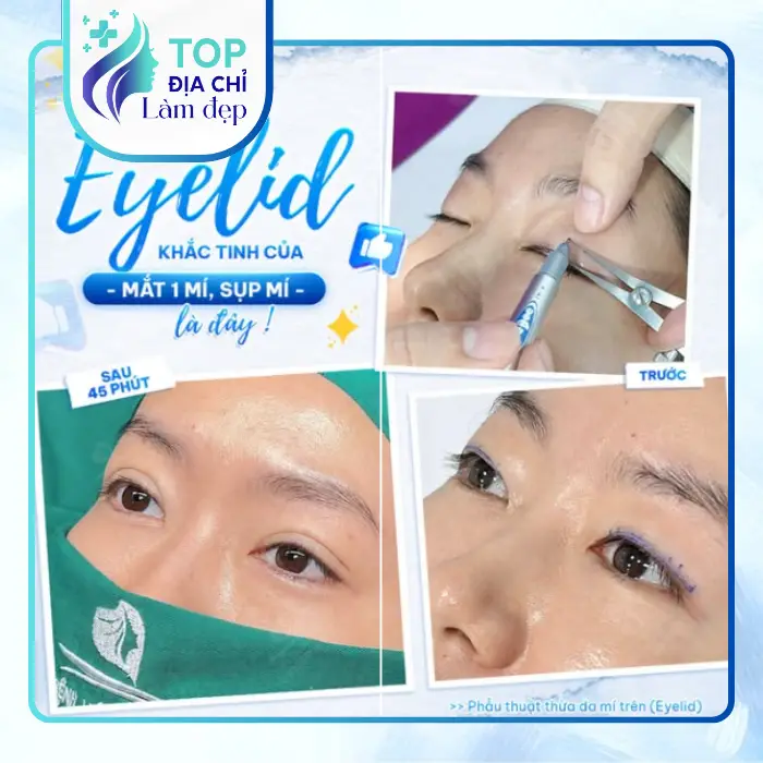 5+ cơ sở cắt mí mắt tại Thái Bình chất lượng cao