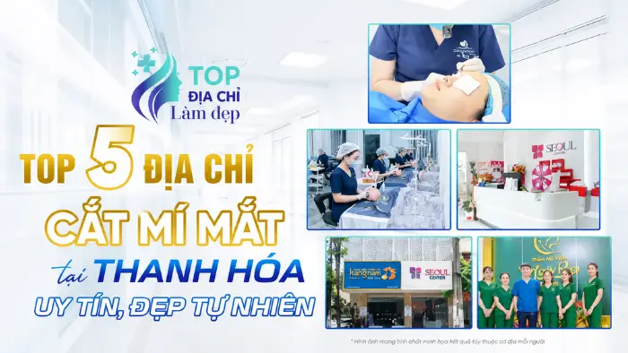 Top 6 Địa Chỉ Cắt Mí Mắt Tại Thanh Hóa Uy Tín, Đẹp Tự Nhiên