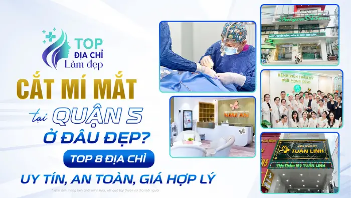 Cắt mí mắt tại Quận 5 ở đâu đẹp? Top 8 địa chỉ uy tín, an toàn, giá hợp lý