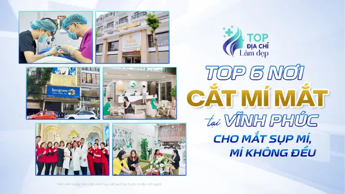 Top 6 nơi cắt mí mắt tại Vĩnh Phúc cho mắt sụp mí, mí không đều
