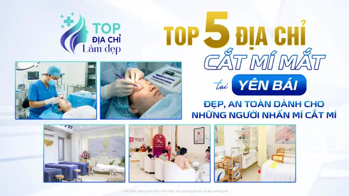 Top 5 địa chỉ cắt mí mắt tại Yên Bái đẹp, an toàn dành cho những người nhấn mí cắt mí