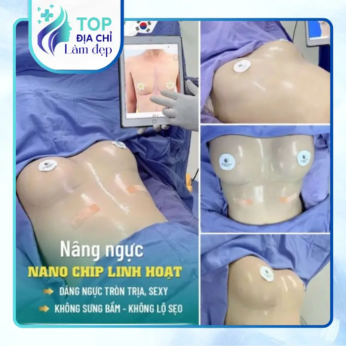 Top 5 Địa Chỉ Nâng Ngực Tại An Giang Uy Tín, Được Nhiều Khách Hàng Quan Tâm