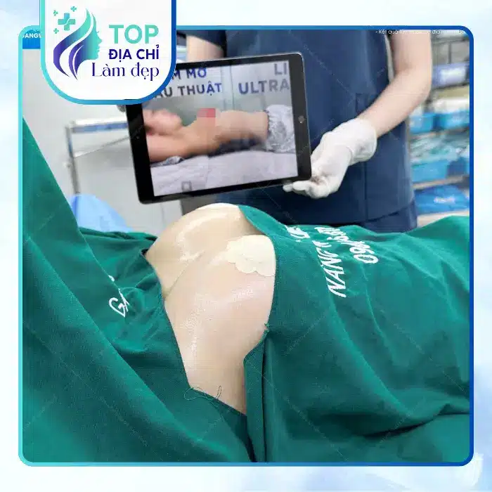 Nâng Ngực Tại Bình Dương: Top 4 Địa Chỉ Cho Kết Quả Hài Hòa, Tự Nhiên