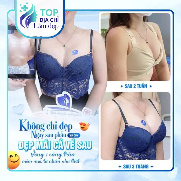 Nâng ngực tại TPHCM