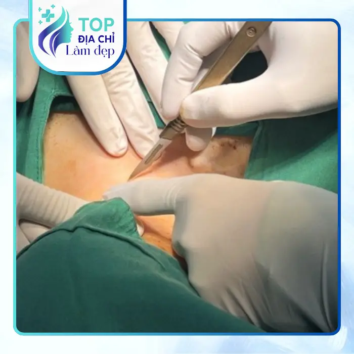 Nâng Ngực Tại Cà Mau Ở Đâu? Tham Khảo Các Địa Chỉ Uy Tín Hiện Nay