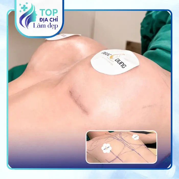 Nâng Ngực Tại Đắk Lắk Ở Đâu? Top 4 Địa Chỉ Làm Đẹp Uy Tín Hiện Nay