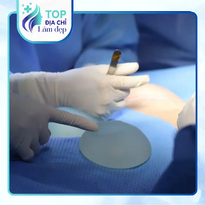 Nâng Ngực Tại Quận Bình Tân: Top 7 Địa Chỉ Uy Tín Đáng Tham Khảo