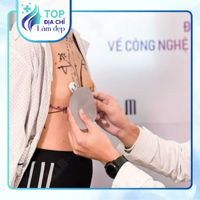 Nâng ngực tại Đắk Nông: Địa chỉ uy tín, chi phí và kinh nghiệm lựa chọn an toàn
