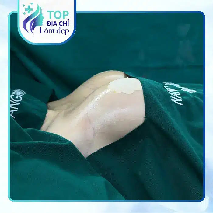 Nâng Ngực Tại Ninh Bình Ở Đâu? Gợi Ý 4 Địa Chỉ Được Nhiều Chị Em Quan Tâm