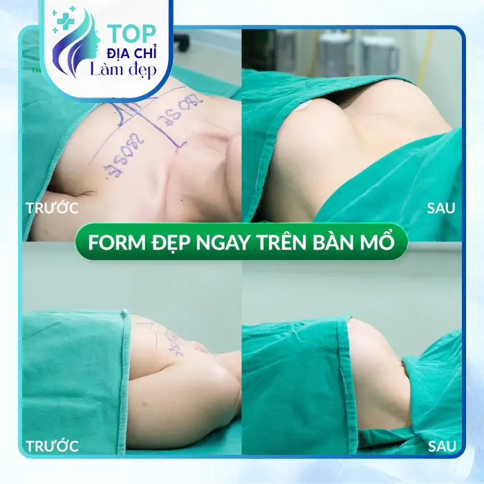 Nâng Ngực Tại Ninh Bình Ở Đâu? Gợi Ý 4 Địa Chỉ Được Nhiều Chị Em Quan Tâm