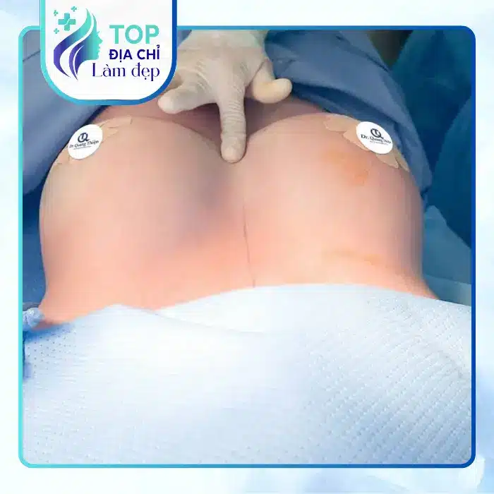 Top Địa Chỉ Nâng Ngực Tại Quận 5 TP.HCM Được Nhiều Khách Hàng Quan Tâm