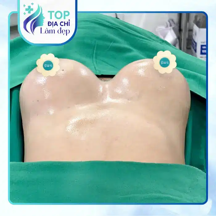 Top Địa Chỉ Nâng Ngực Tại Quận 6 TP.HCM Được Nhiều Khách Hàng Quan Tâm