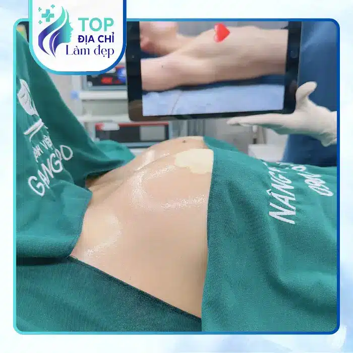 Nâng Ngực Tại Gò Vấp: Gợi Ý 6 Địa Chỉ Uy Tín Hiện Nay