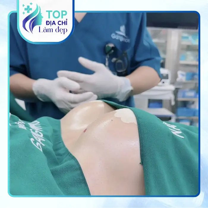 Top 6 Địa Chỉ Nâng Ngực Quận Phú Nhuận TP.HCM Uy Tín