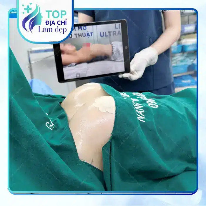Nâng Ngực Tại Quảng Ninh: Gợi Ý 5 Địa Chỉ Uy Tín Hiện Nay