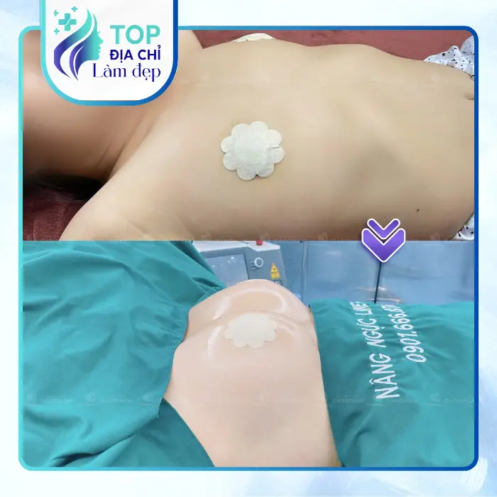 Nâng Ngực Tại Quảng Trị Ở Đâu? Gợi Ý 4 Địa Chỉ Được Nhiều Khách Hàng Tham Khảo