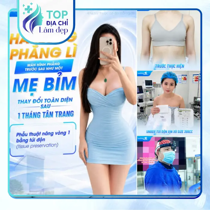 Nâng Ngực Tại Tây Ninh Ở Đâu Uy Tín? Top 4 Cơ Sở Được Nhiều Khách Hàng Quan Tâm