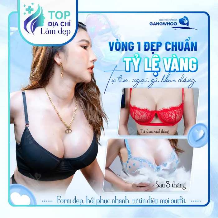 Nâng Ngực Tại Thanh Hóa: 6 Địa Chỉ Nổi Bật Hiện Nay