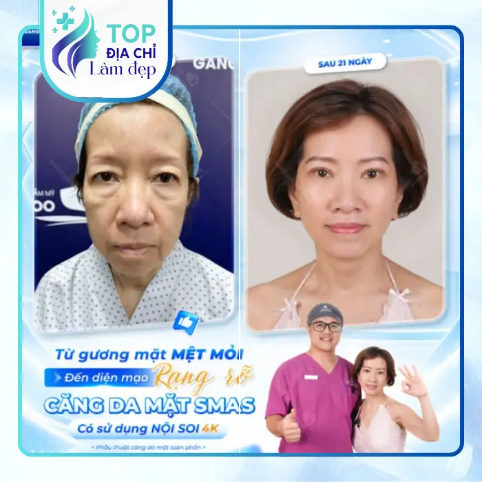 Top 5 Địa Chỉ Căng Da Mặt Tại Cần Thơ Được Nhiều Khách Hàng Quan Tâm