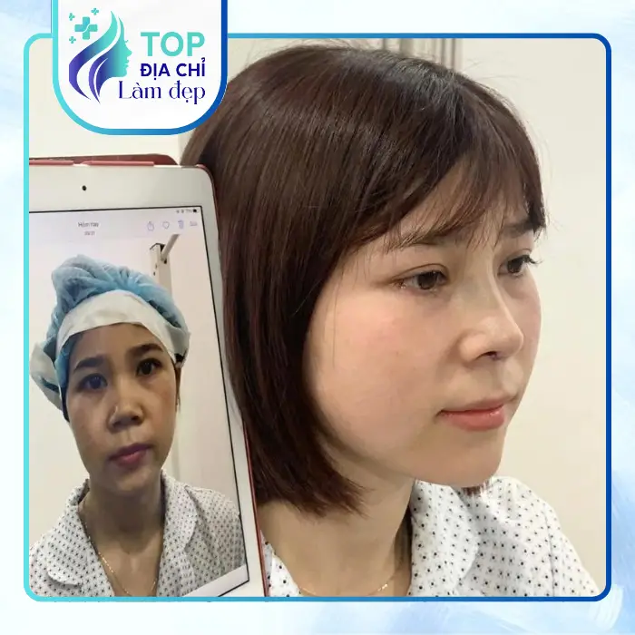Khám Phá Top 5 Địa Chỉ Căng Da Mặt Tại Cao Bằng Và Khu Vực Lân Cận